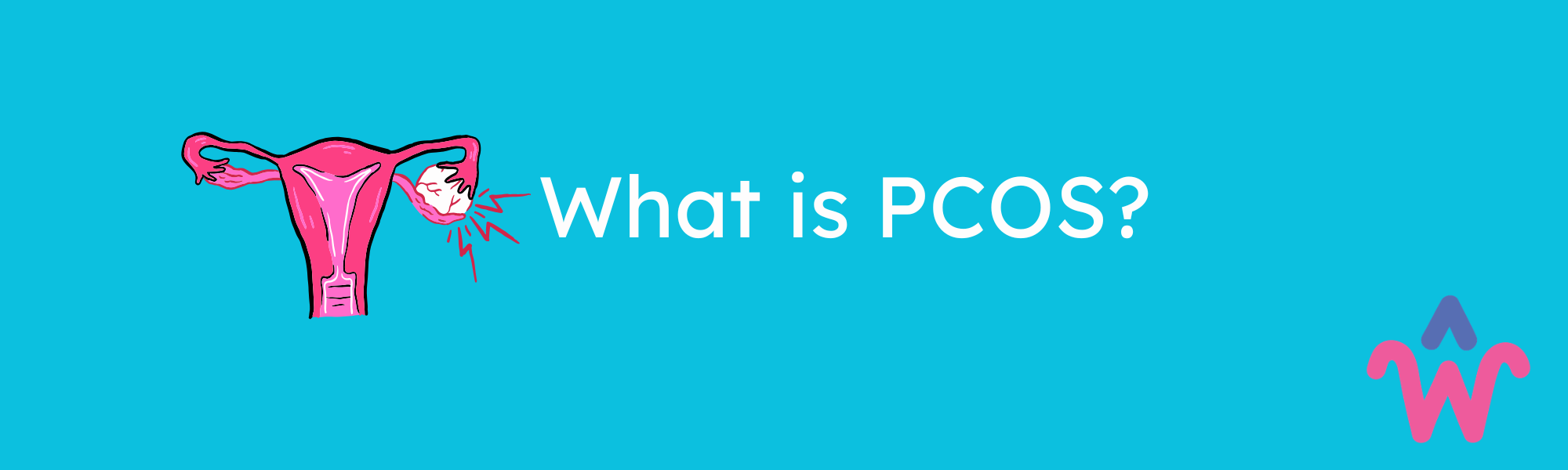 What is Polycystic Ovary Syndrome (PCOS)